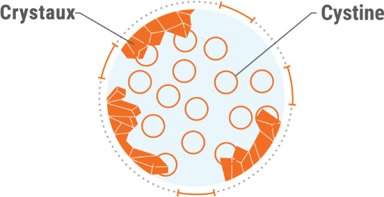 Targeting cystinosis treatment goals