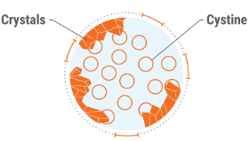 Targeting cystinosis treatment goals